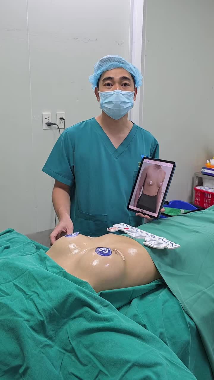 Kết quả nâng cấp V1 túi GCA cho KH sn 2002