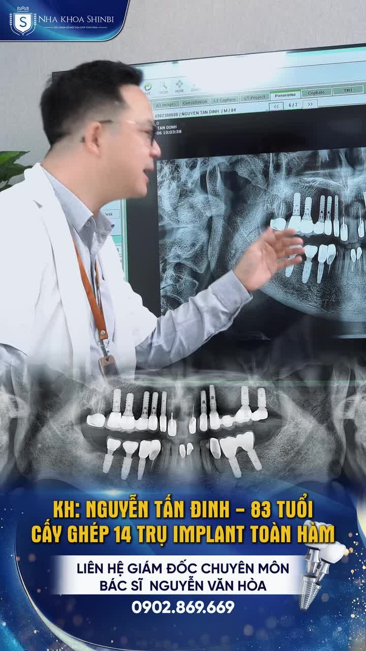 Tuổi tác không ngăn được mong muốn ăn ngon – sống vui – cười tự tin. Ca Implant của bác hôm nay là lời khẳng định: