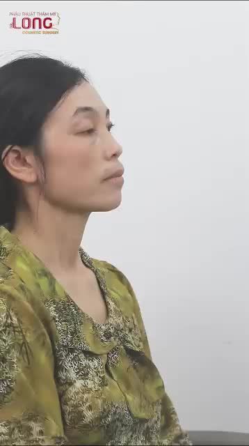 Chấm dứt sự chịu đựng, mệt mỏi ngần ấy năm. Suốt hơn 40 năm qua, chị khách phải sống với đôi mắt yếu cơ, nặng nề, che mờ cả tầm nhìn lẫn nhan sắc.