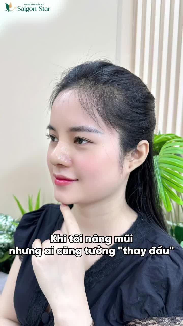 Dáng mũi quyết định đến 70% nhan sắc không sai cả nhà nhỉ!!!!