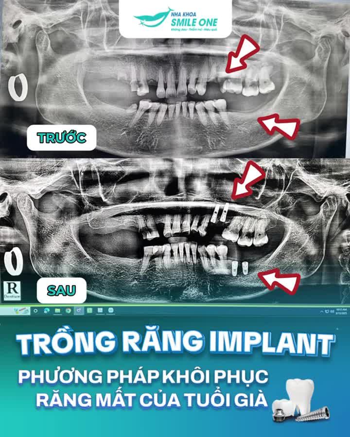 Điều gì khiến tuổi già của các cô chú "sung sướng" nhất?