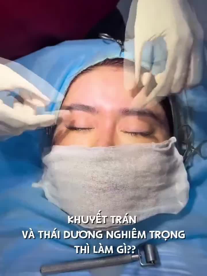 KHUYẾT LÕM TRÁN VÀ THÁI DƯƠNG THÌ NÊN LÀM GÌ?