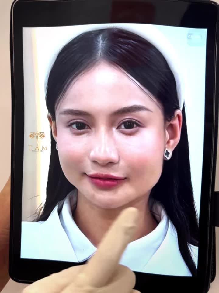 Ít ai biết, một thói quen thường ngày lại làm gương mặt càng này to hơn.Đó chính là ăn nhai một bên, khiến cho cơ góc hàm phát triển, gương mặt mất cân đối.