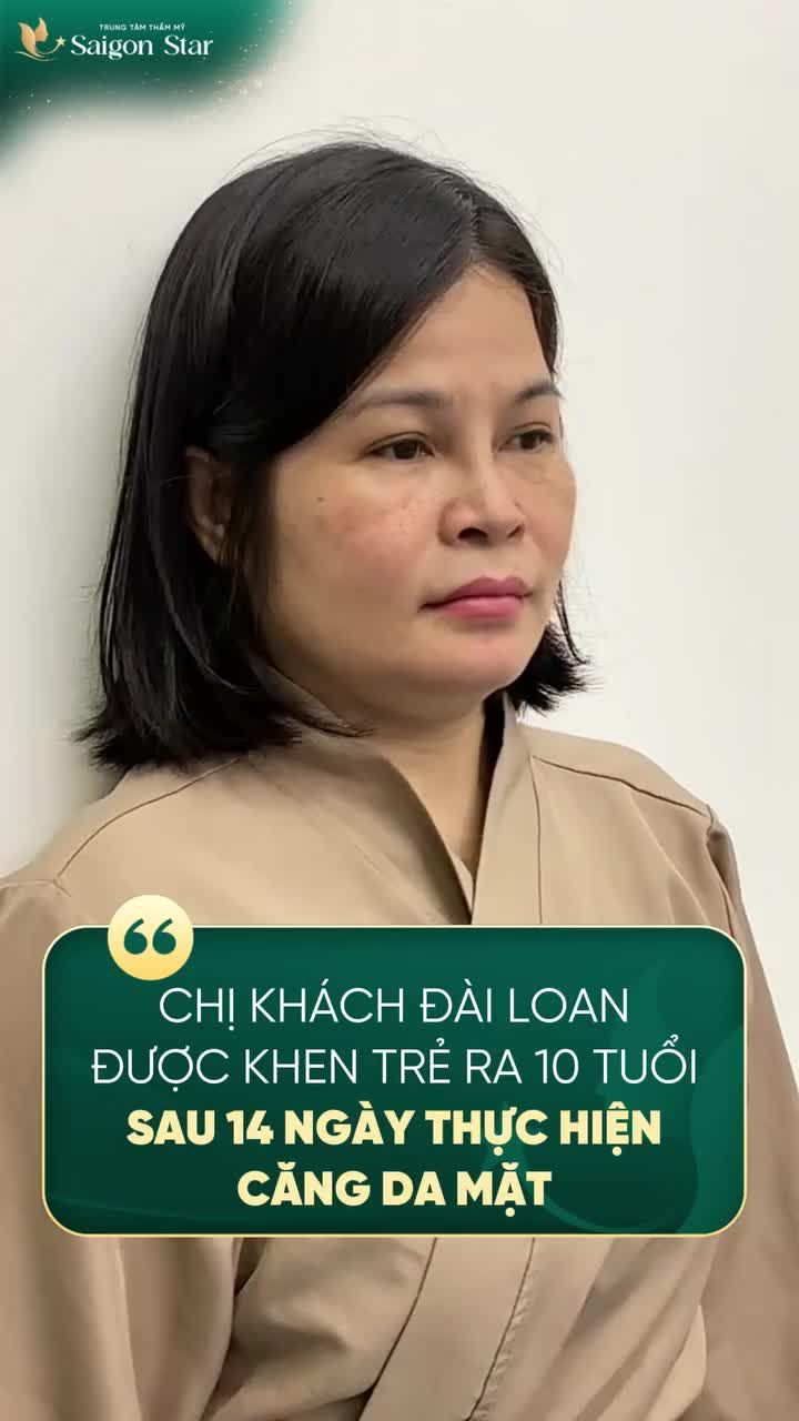 CẢM GIÁC SAU 14 NGÀY THỰC HIỆN CĂNG DA MẶT SẼ NHƯ THẾ NÀO???