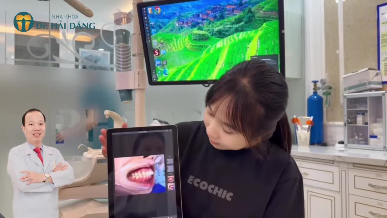 CHÚC MỪNG EM LY CHÍNH THỨC THÁO NIỀNG