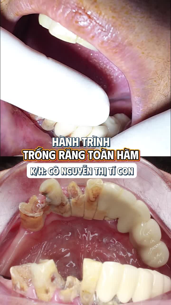 Răng miệng thế này, làm sao ăn ngon, ngủ yên?