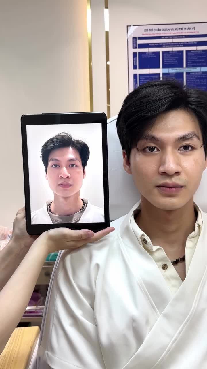 Biến “khuyết điểm” trở thành “tâm điểm” trong 60 phút với Công nghệ Thon gọn hàm Vline Perfect.