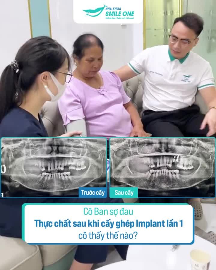 Hành trình khôi phục 10 chiếc răng của cô Ban cùng Ths. BS Tuấn Dương!