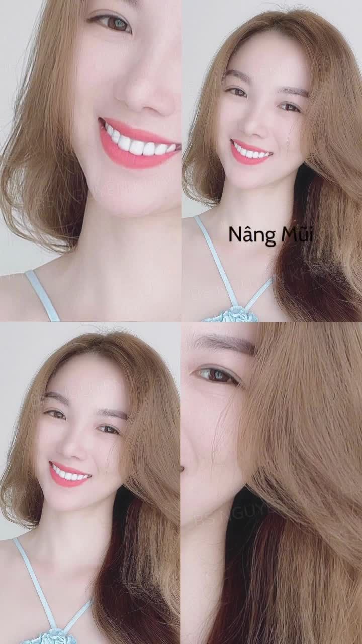 Nàng khách sau 6 tháng nhìn xinh rạng rỡ hơn bao giờ hết.