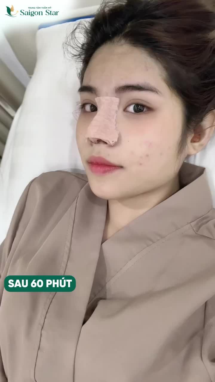 Chỉ sau 10 ngày, chiếc mũi thấp tẹt đã thành chuyện quá khứ.