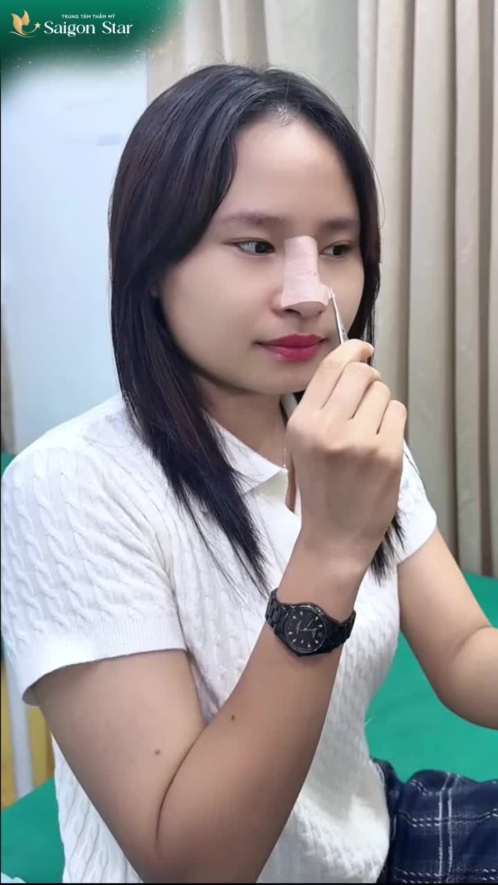 KHOE CẢ NHÀ DÁNG MŨI NGAY SAU KHI THÁO NẸP CỦA EM KHÁCH HÀNG 2K6