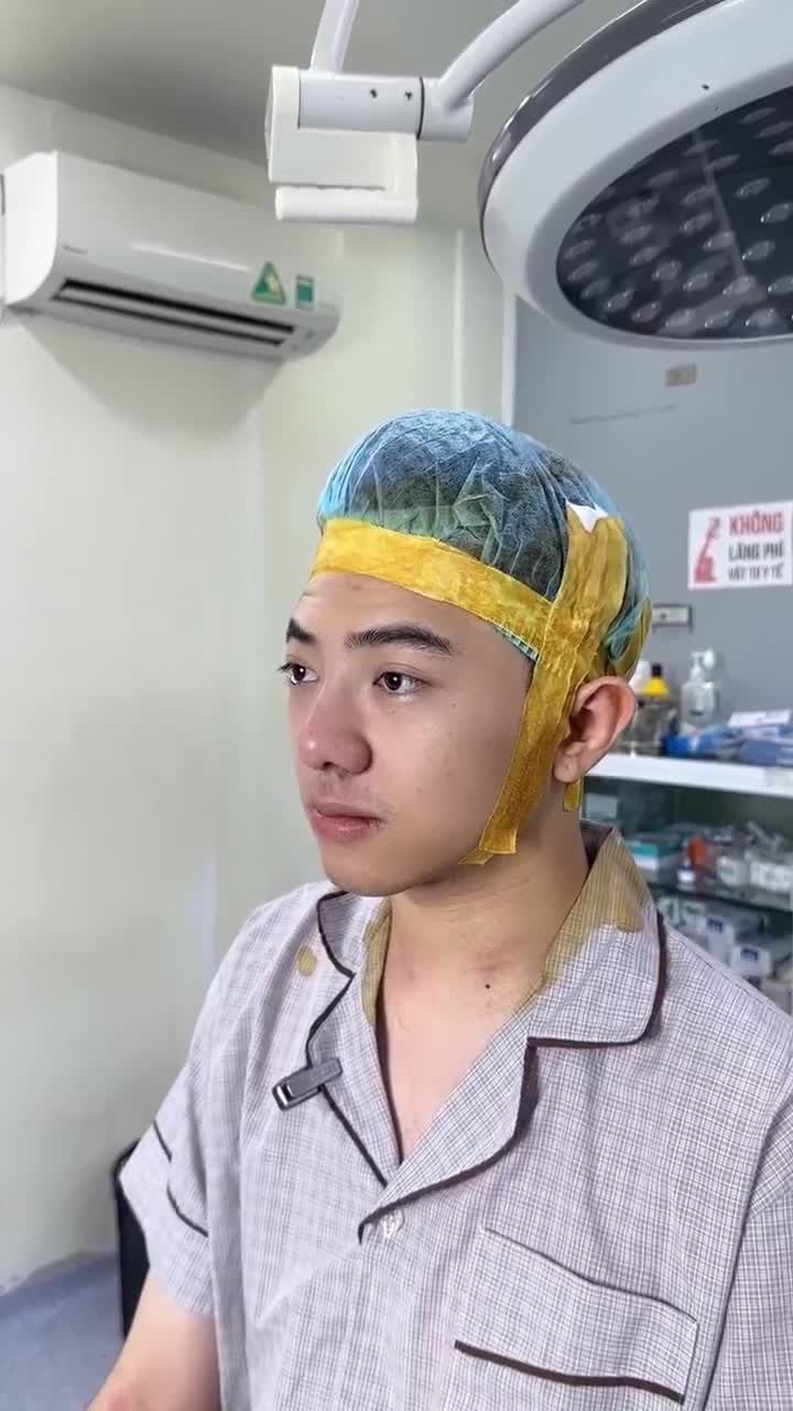KẾT QUẢ NÂNG MŨI CẤU TRÚC KH. JUSTIN HOANG (FROM AMERICA)
