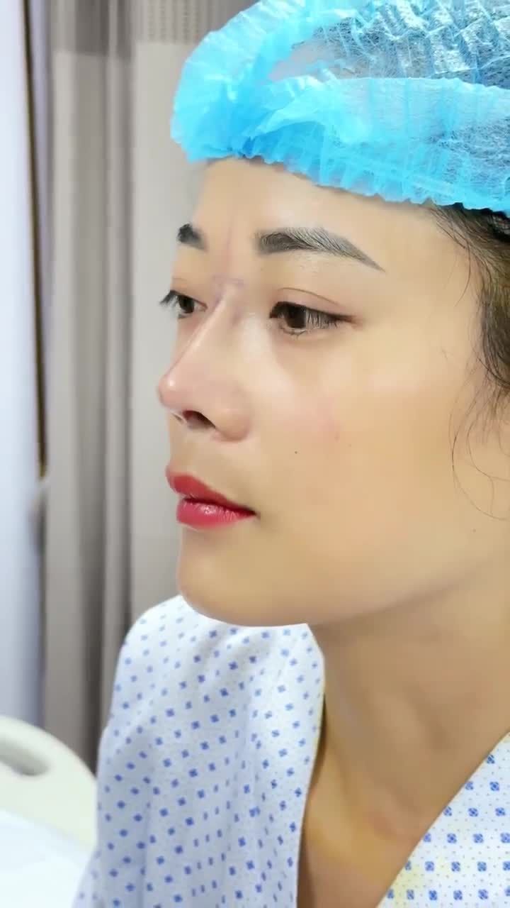 BẠN NỮ TRẺ TUỔI LỘT XÁC NHAN SẮC SAU 60 PHÚT NÂNG MŨI TẠI BỆNH VIỆN THẨM MỸ GANGWHOO – DÁNG MŨI THANH TÚ, GƯƠNG MẶT HÀI HÒA!