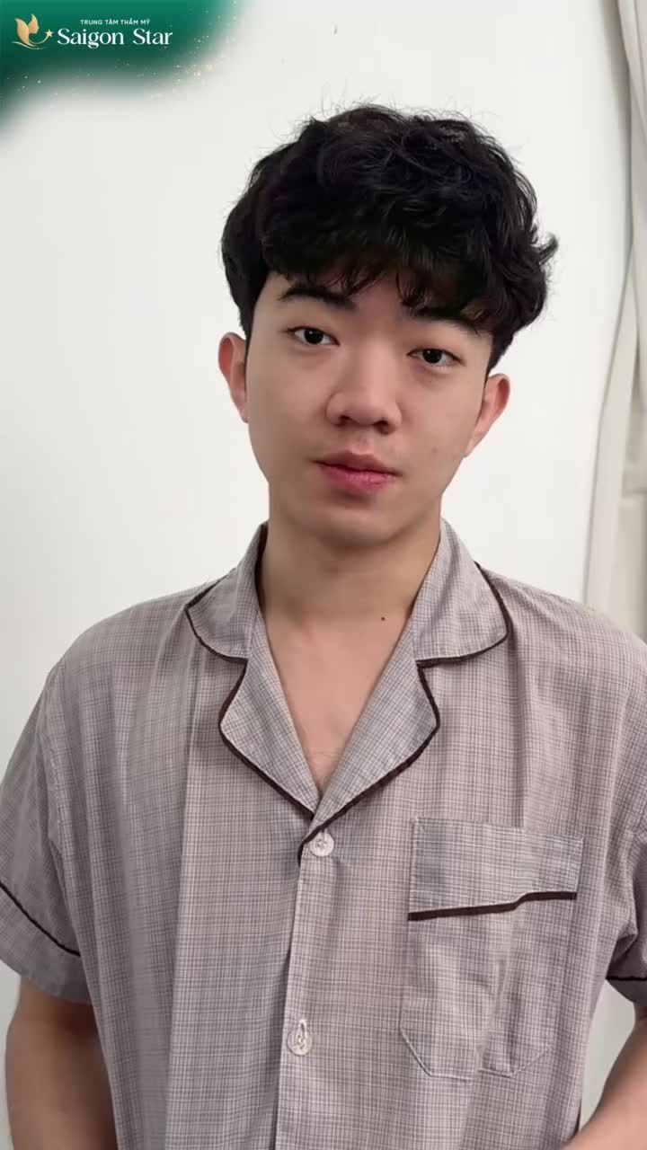 TRẢ DÁNG MŨI NAM TÍNH CHO EM TRAI JUSTIN HOÀNG (VIỆT KIỀU MỸ) - CHỈ SAU 10 NGÀY NÂNG MŨI CẤU TRÚC