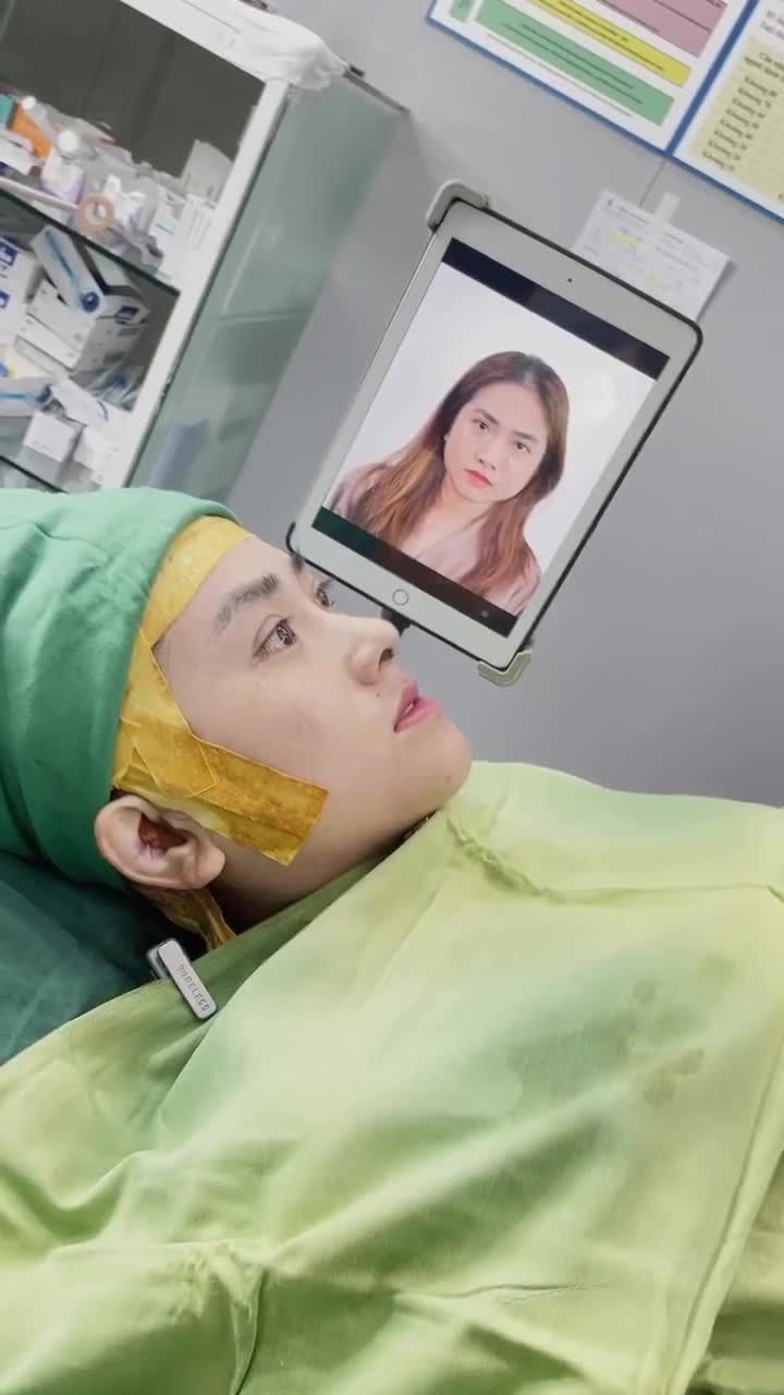 KHÁCH HÀNG NGỠ NGÀNG KHI NHÌN THẤY DÁNG MŨI SAU 60 PHÚT PHẪU THUẬT