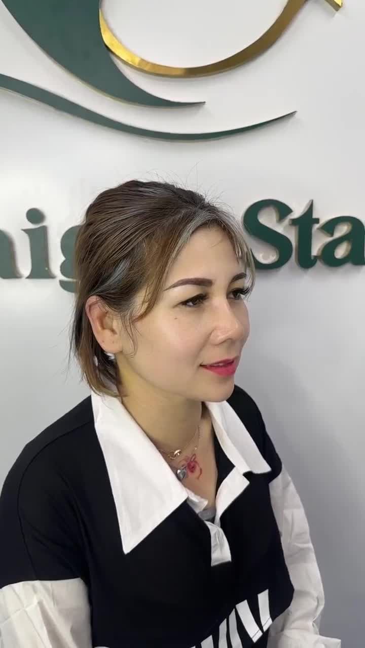 CẬN CẢNH DÁNG MŨI SAU 14 NGÀY THỰC HIỆN NÂNG MŨI CẤU TRÚC CỦA CHỊ THU HÀ (VIỆT KIỀU MỸ)