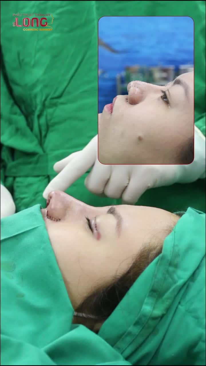 Đầu tháng khách tậu ngay chiếc mũi xinh mừng 80 năm ngày Quốc khánh.