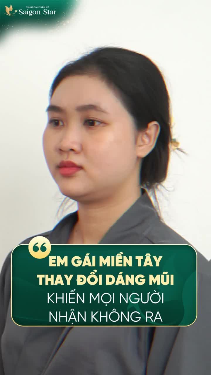 CÁI KẾT QUÁ VIÊN MÃN CHO EM GÁI "MUỐN DÁNG MŨI PHÙ HỢP VỚI MÌNH"
