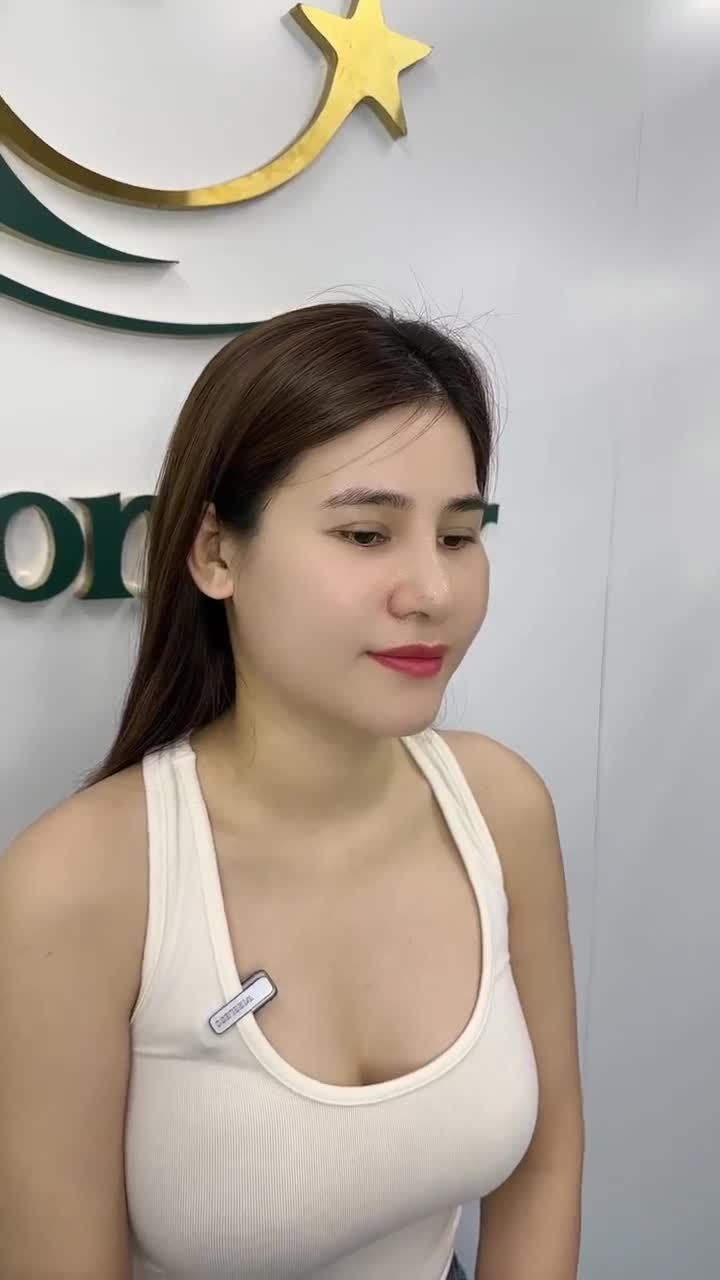 10 NGÀY NÂNG MŨI SỬA LẠI KH. BÍCH TRÂM
