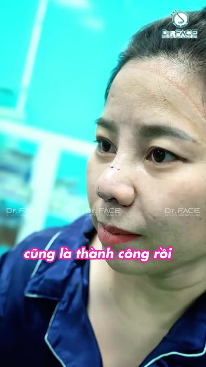 Mũi này “ĐỘC LẠ” lắm – CHIA LÀM ĐÔI rõ rệt