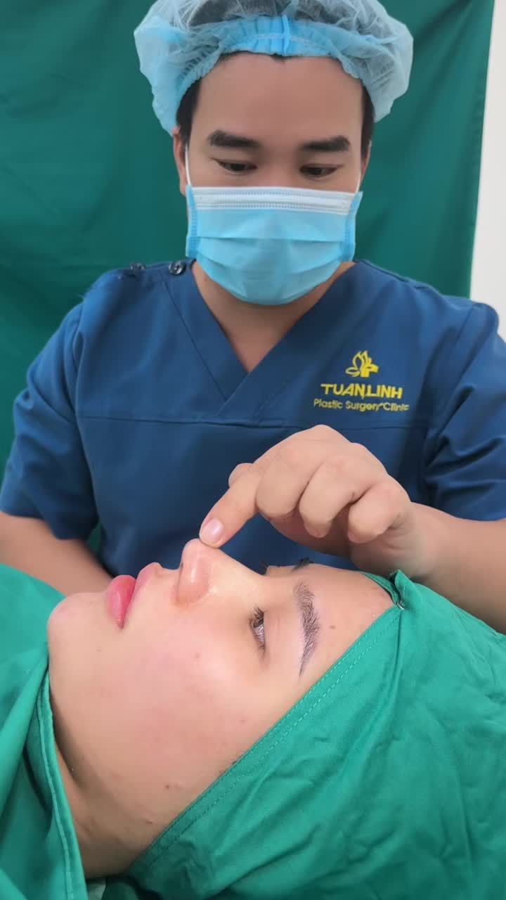 Case mũi cấu trúc vừa hoàn thành - Dáng mũi đẹp xuất sắc ngay sau phẫu thuật.