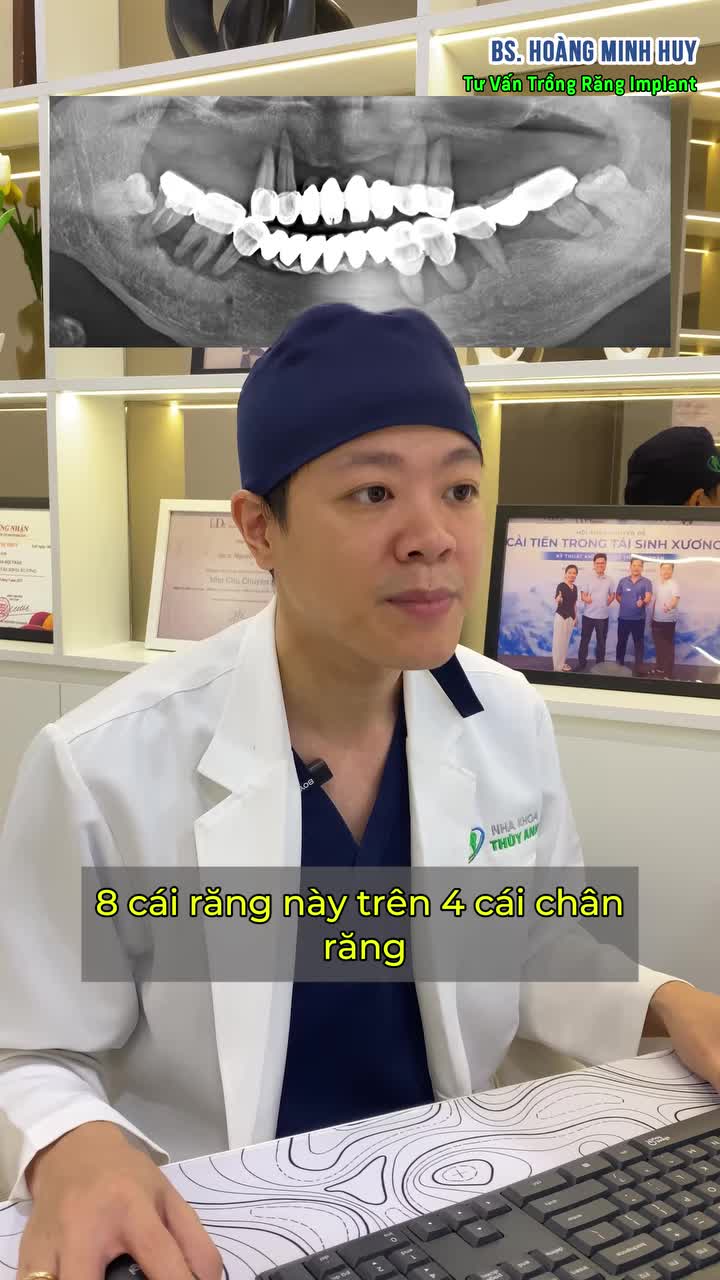 LÀM CẦU RĂNG SỨ SAI KỸ THUẬT - HỆ LỤY NHÌN THẤY KHIẾN BÁC SĨ CŨNG XÓT XA!