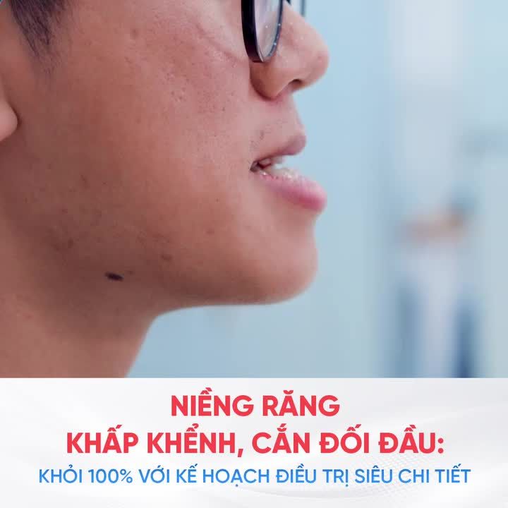 Niềng răng khấp khểnh, cắn đối đầu – Khỏi 100% với kế hoạch điều trị siêu chi tiết tại Lạc Việt Intech
