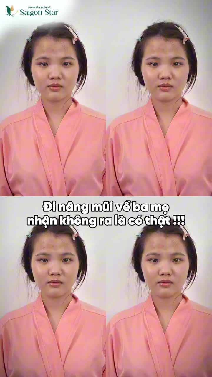 DỞ KHÓC DỞ CƯỜI CHUYỆN EM KHÁCH GENZ ĐI NÂNG MŨI VỀ BỐ MẸ NHẬN KHÔNG RA