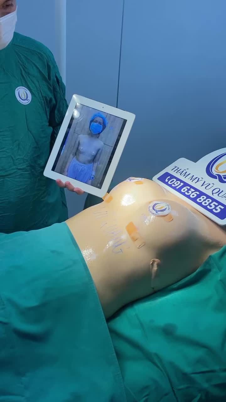 Chia sẻ của bác sĩ sau nâng cấp vòng 1