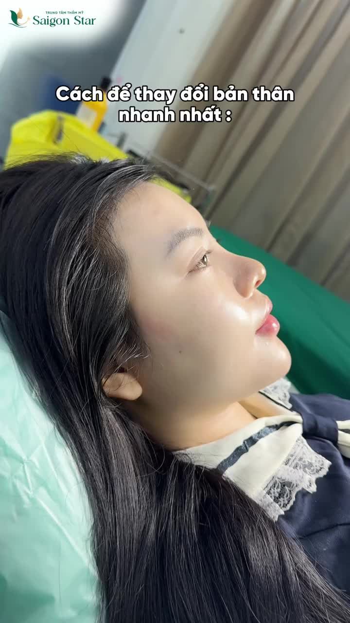 EM GÁI 2K3 THAY DỔI ĐẾN "KHÔNG NHẬN RA CHÍNH MÌNH" CHỈ SAU 10 NGÀY NÂNG MŨI CẤU TRÚC DR. HOẠT!!!