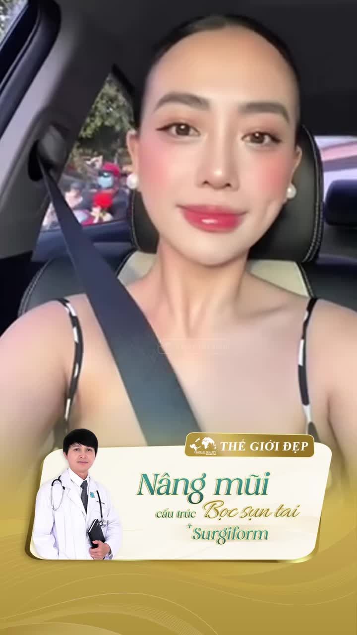 Thêm một feedback vừa được gửi về cho Thế Giới Đẹp ?̣? từ Khách hàng 9x chỉ sau vài tháng thực hiện nâng mũi.
