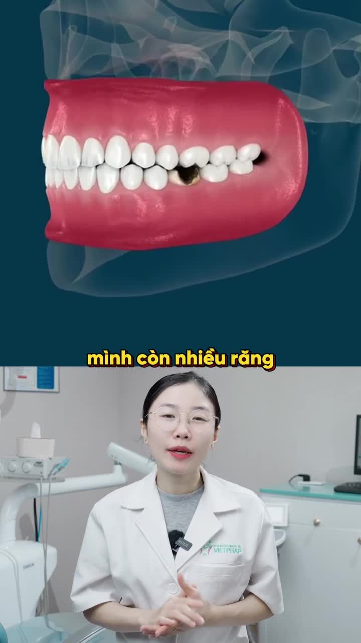 HẬU QUẢ MẤT 1 RĂNG