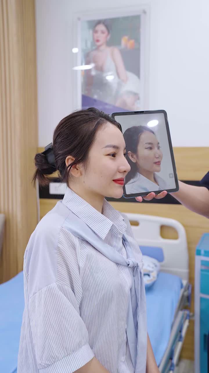 Bs Vũ Quang tái khám cho khách hàng sau 1 tháng thực hiện dịch vụ nâng mũi cấu trúc softline
