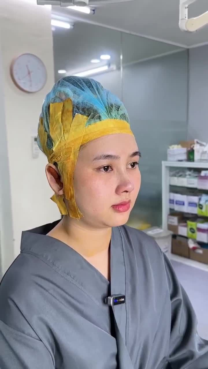 NÂNG MŨI CẤU TRÚC SURGIFORM – KH: TÂM ĐOAN (CÀ MAU)
