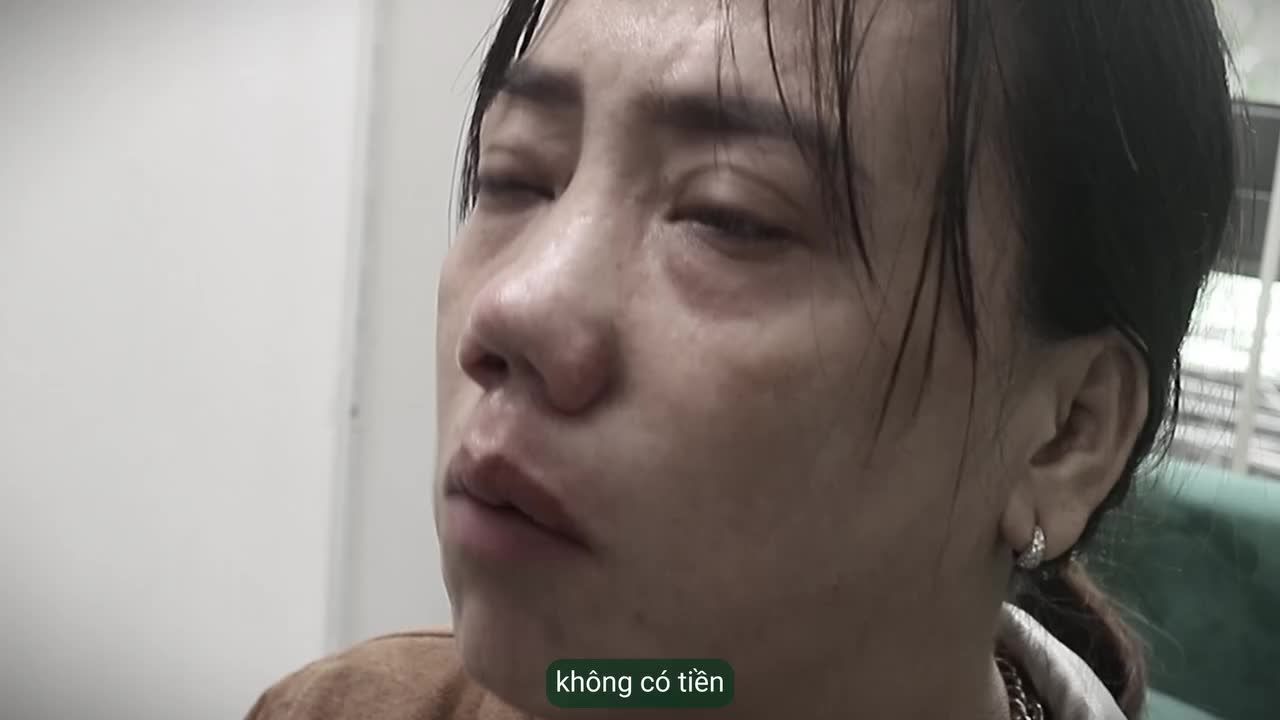 ĐƯỢC TÀI TRỢ CHI PHÍ, CÔ KHÁCH HÀNG XÚC ĐỘNG VÌ CHIẾC MŨI ĐƯỢC CỨU