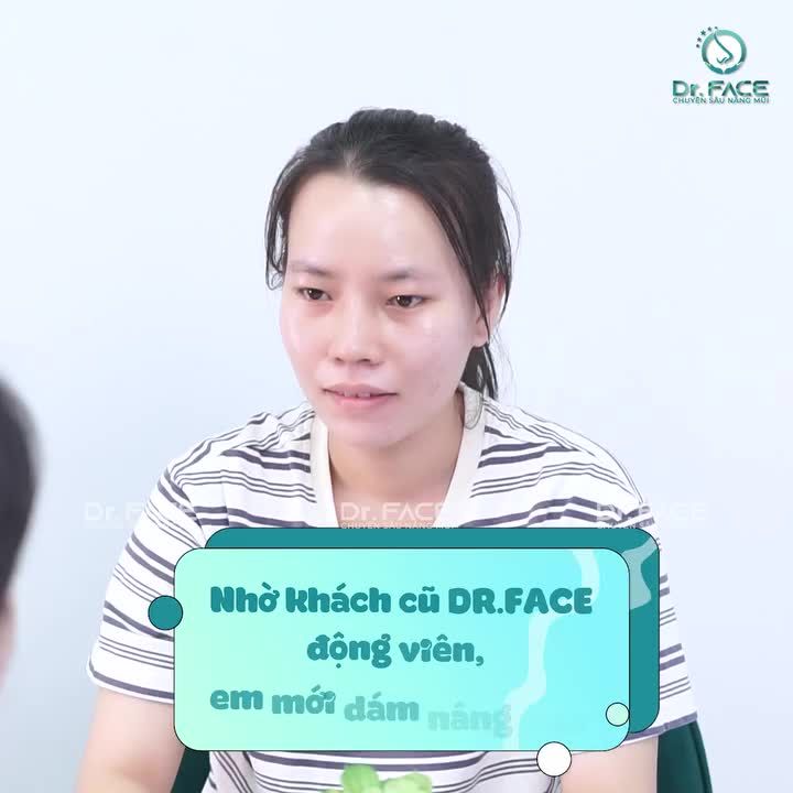 Sau 14 ngày, ai gặp cũng khen. Thậm chí khách hàng của DR.FACE còn ngờ ngợ, không biết mũi này đã nâng hay chưa vì quá hài hòa.