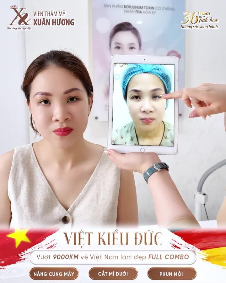 Hành trình bay hơn 9.000km từ Đức về Việt Nam – chị khách Việt kiều Đức đã tin tưởng chọn Viện Thẩm Mỹ Xuân Hương để “thăng hạng nhan sắc” với combo: Nâng cung mày – Cắt mí dưới – Phun môi.
