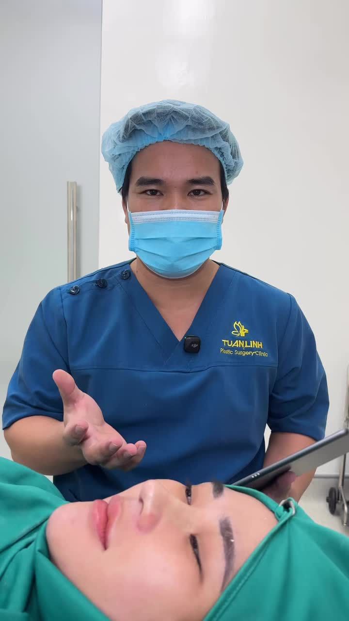 Case mũi cấu trúc surgiform vừa hoàn thành!!