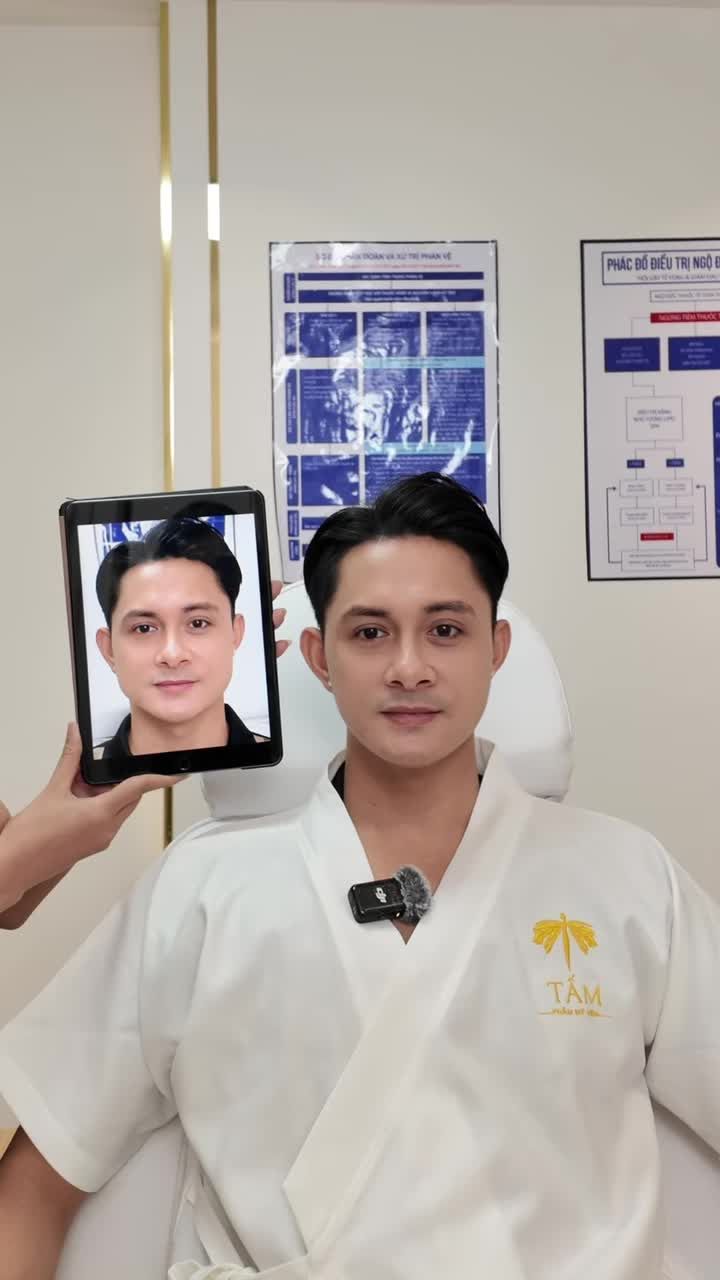 Gặp lại khách hàng đã làm Vline Perfect cách đây 2 tháng, hôm nay bạn tới theo lịch hẹn để tái khám.