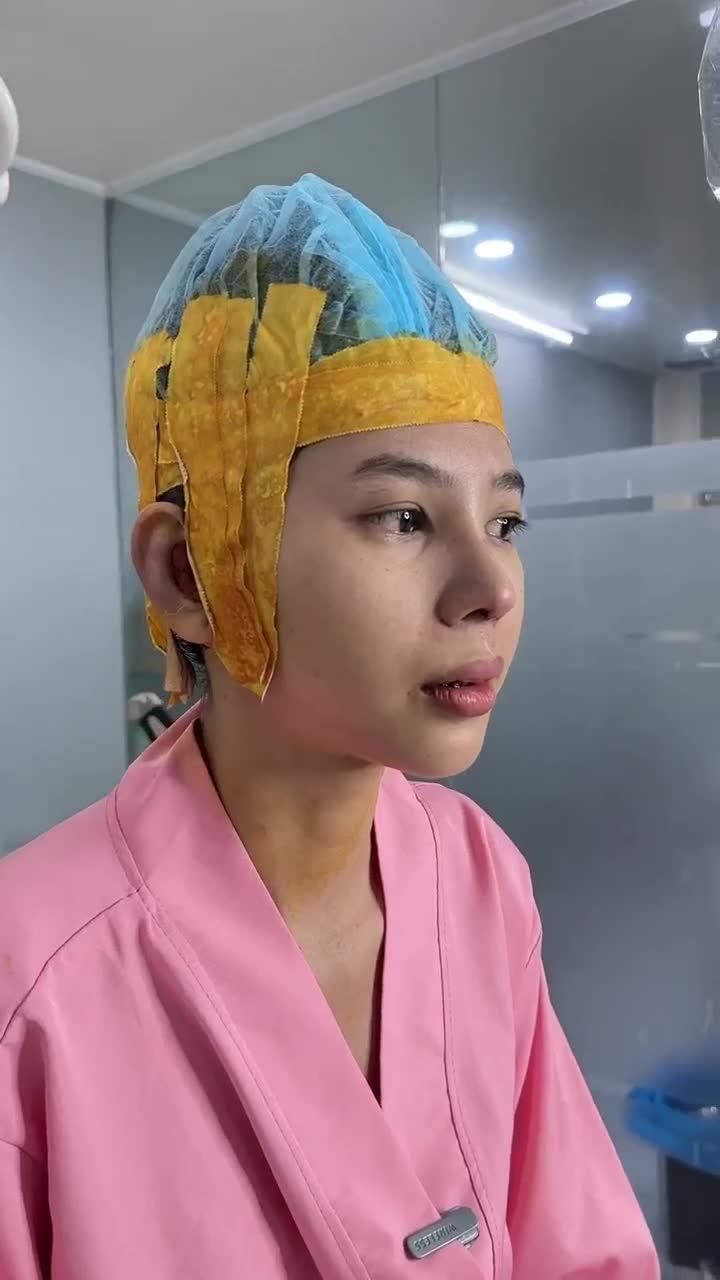 KẾT QUẢ NÂNG MŨI CẤU TRÚC KH. ANH THƯ (BÌNH DƯƠNG)