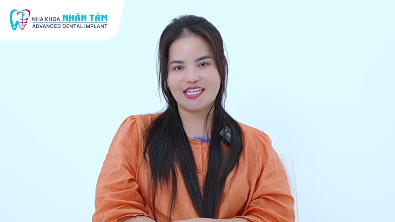 KHẮC PHỤC TÌNH TRẠNG RĂNG CÁNH BƯỚM VỚI GIẢI PHÁP RĂNG SỨ TỰ NHIÊN