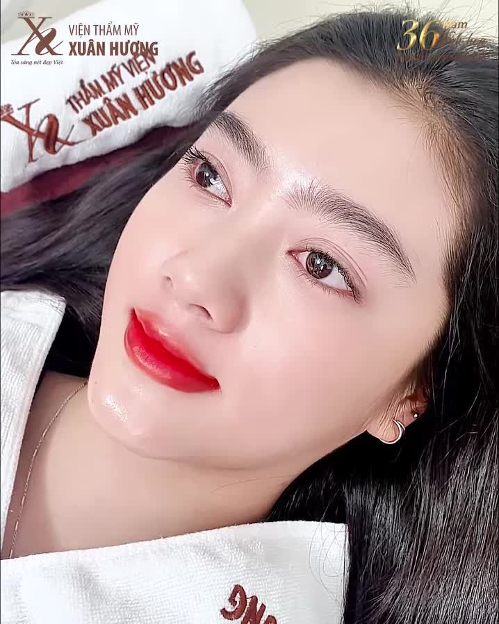 Đôi môi kém sắc, nhợt nhạt được “tái sinh” hồng hào, rạng rỡ, trong veo chuẩn tự nhiên tại VTM Xuân Hương.