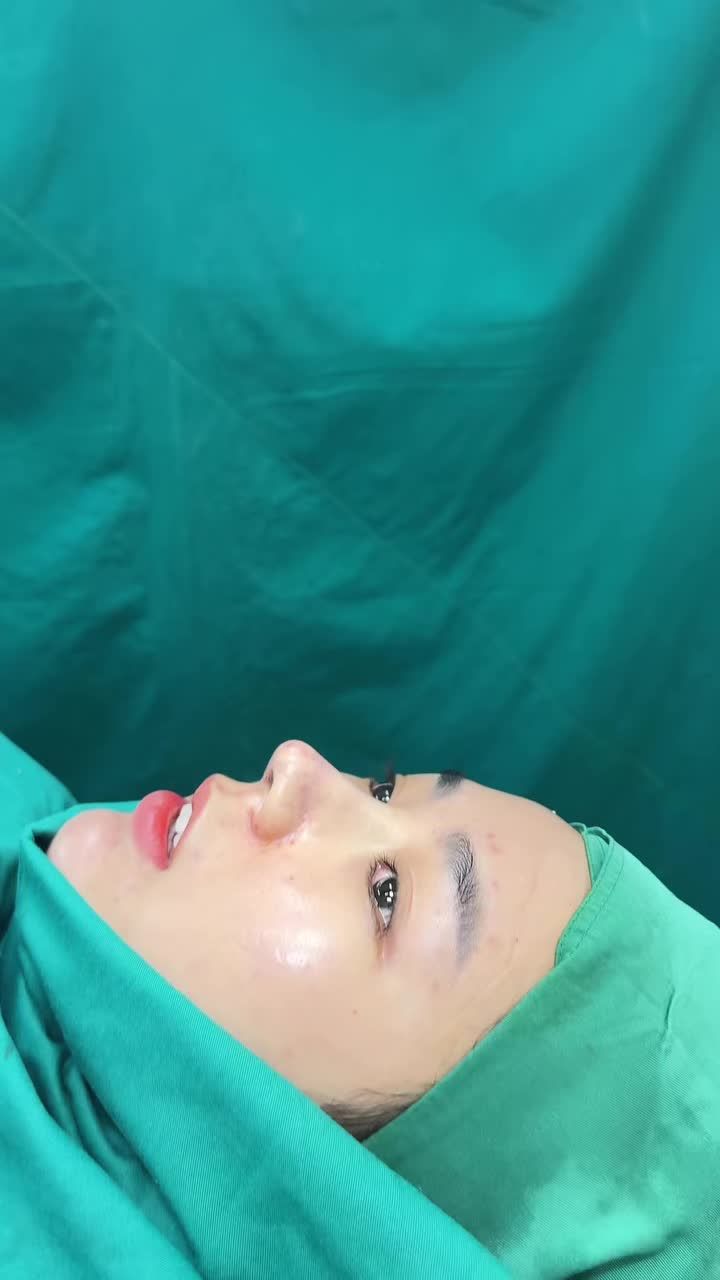 Case cấu trúc surgiform vừa hoàn thành!!