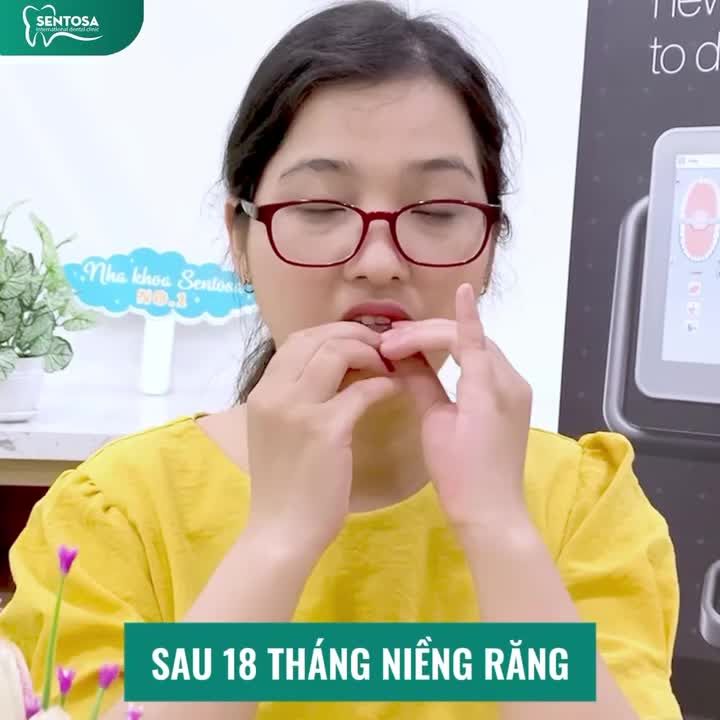 TẠM BIỆT KHAY NIỀNG “FAKE” – CHỌN INVISALIGN CHUẨN MỸ VỚI GIÁ TỪ 25.000.000Đ