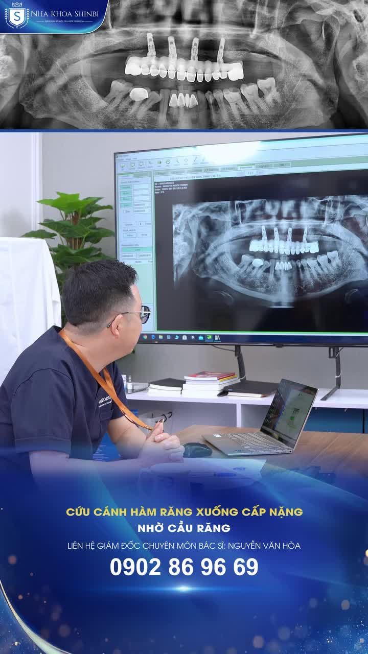 Giải pháp nào cho hàm răng xuống cấp nặng ở tuổi xế chiều?