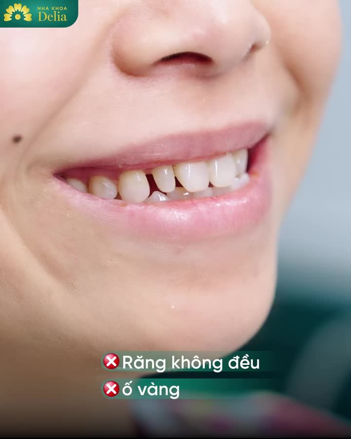 SỨC MẠNH CỦA MỘT NỤ CƯỜI MỚI