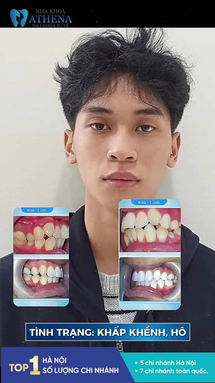 Tránh đường cho zai đẹp đi qua!!!