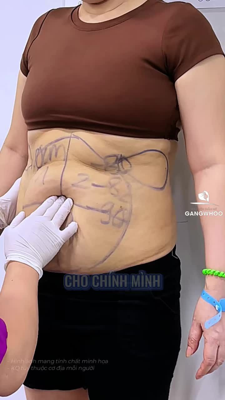 Dành cả tuổi thanh xuân để chăm lo cho gia đình, lần đầu tiên mẹ dành tặng cho bản thân một món quà ý nghĩa tại BVTM Gangwhoo