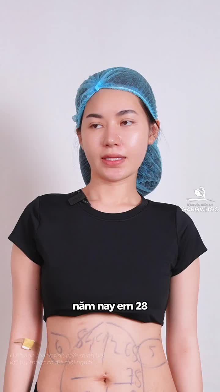 Chị Thảo - Mẹ 1 con - Sau 7 ngày giảm mỡ bụng Lipo Ultrasound đã sở hữu vòng eo con kiến, quyến rũ, tự tin diện bikini