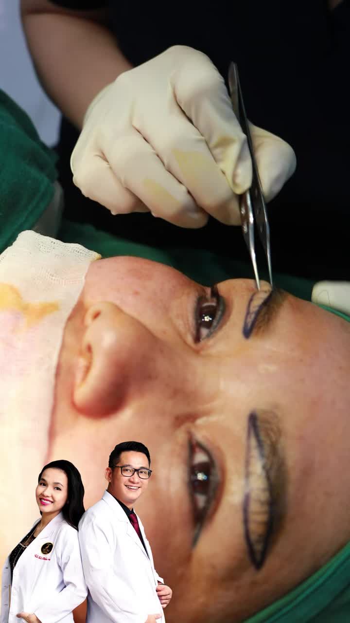 SỢ ĐAU – SỢ SẸO – SỢ GIÀ? Bí quyết trẻ hóa mắt đã có lời giải!